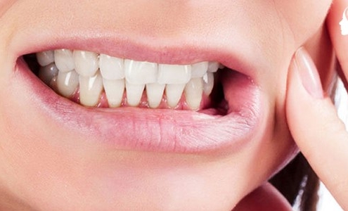 تاثیر دندان قروچه بر ایمپلنت دندان